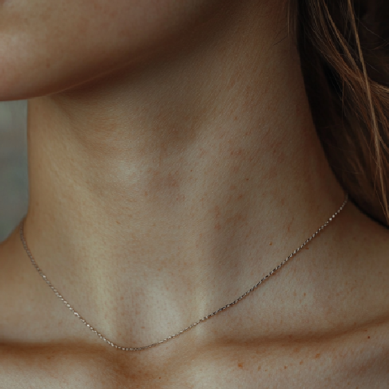 Kaelakortsud: miks need juhtuvad ja kuidas neist lahti saada